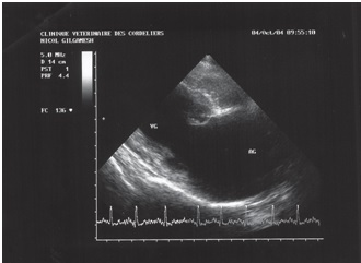 Fig 5 Echo 2